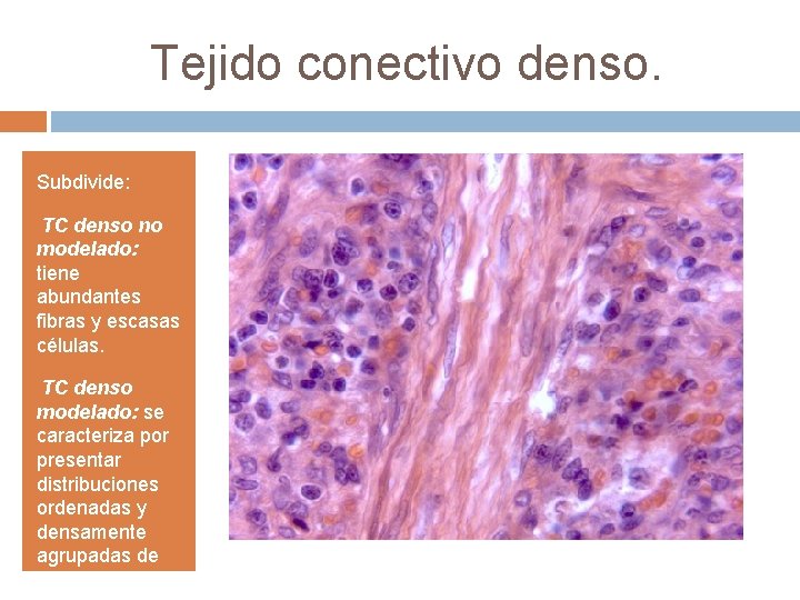 Tejido conectivo denso. Subdivide: • TC denso no modelado: tiene abundantes fibras y escasas