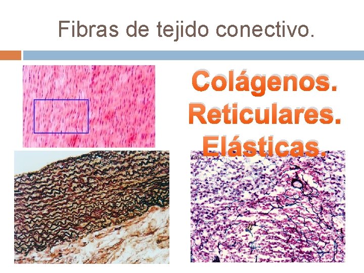 Fibras de tejido conectivo. Colágenos. Reticulares. Elásticas. 