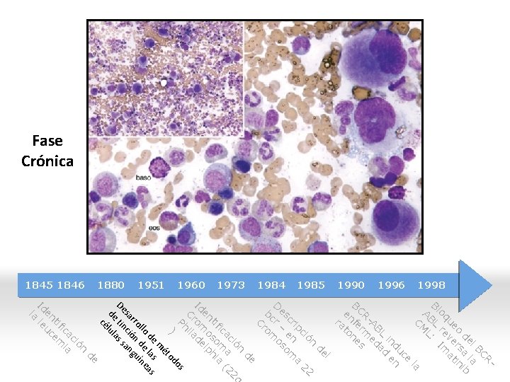 Fase Crónica 1998 1996 1990 1985 1984 1973 1960 1951 1880 1845 1846 CR