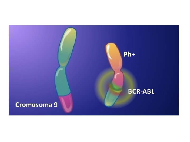 Ph+ BCR-ABL Cromosoma 9 