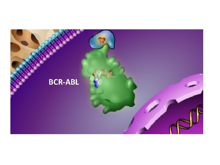 BCR-ABL 