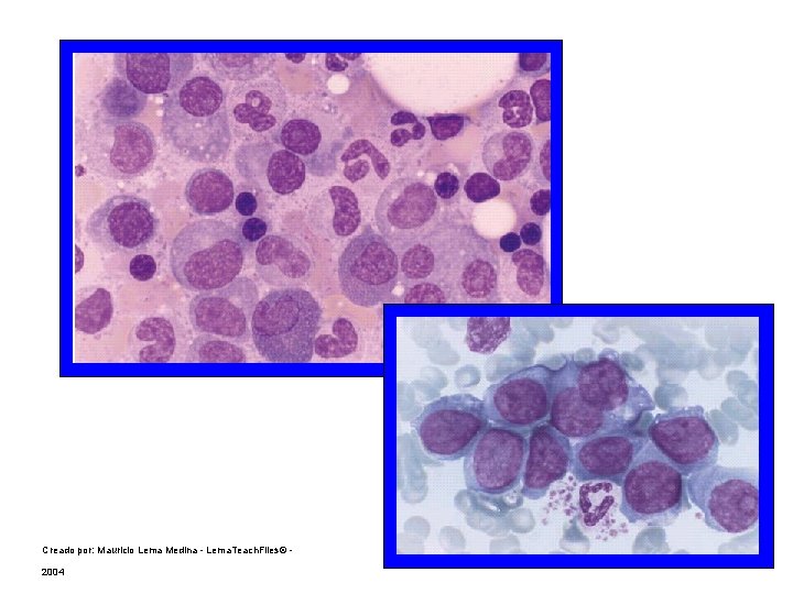 Creado por: Mauricio Lema Medina - Lema. Teach. Files© 2004 