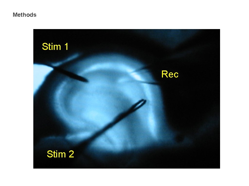 Methods Stim 1 Rec Stim 2 