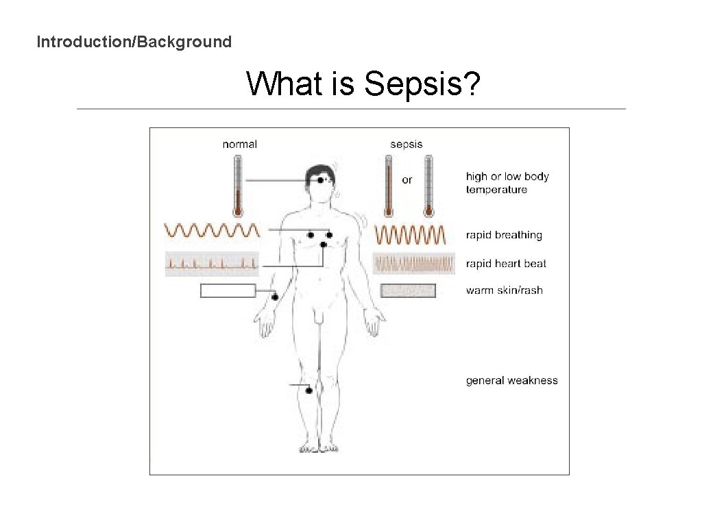 Introduction/Background What is Sepsis? 
