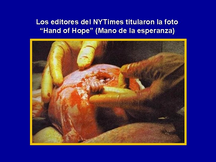 Los editores del NYTimes titularon la foto “Hand of Hope” (Mano de la esperanza)