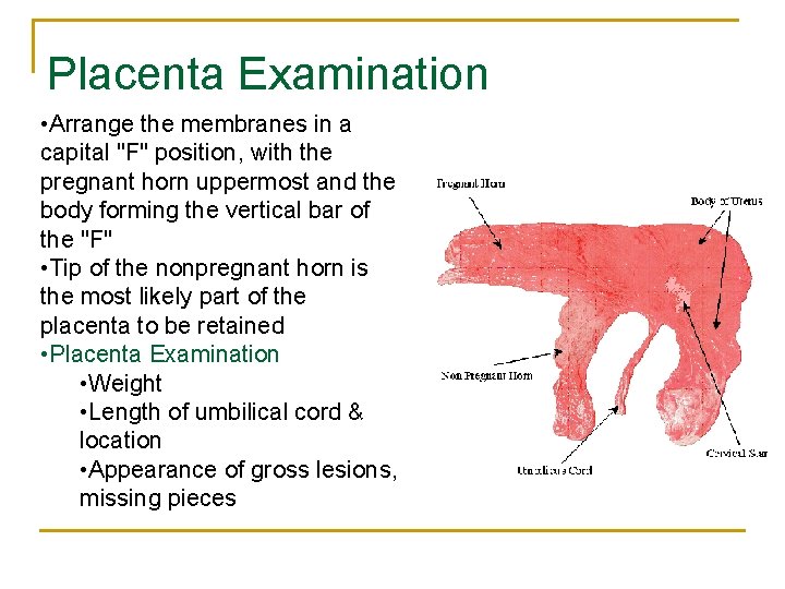Placenta Examination • Arrange the membranes in a capital "F" position, with the pregnant