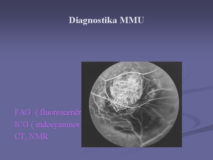 Diagnostika MMU FAG ( fluorescenční angiografie ) ICG ( indocyaninová angiografie ) CT, NMR