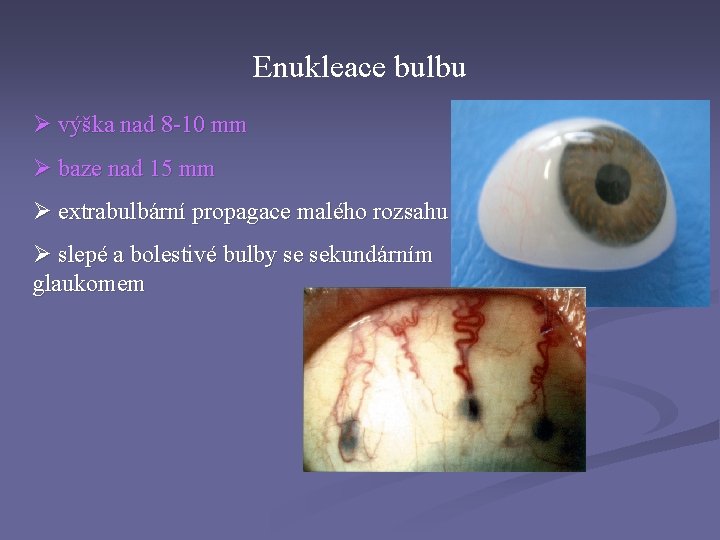 Enukleace bulbu Ø výška nad 8 -10 mm Ø baze nad 15 mm Ø