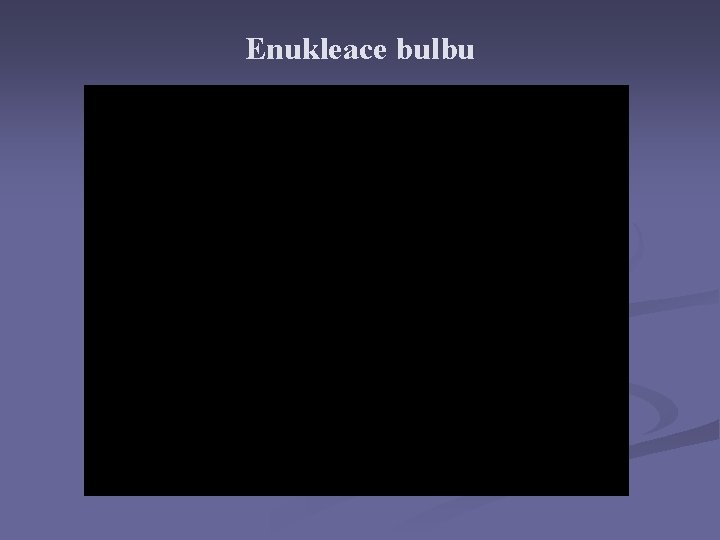 Enukleace bulbu Enukleace bulbu