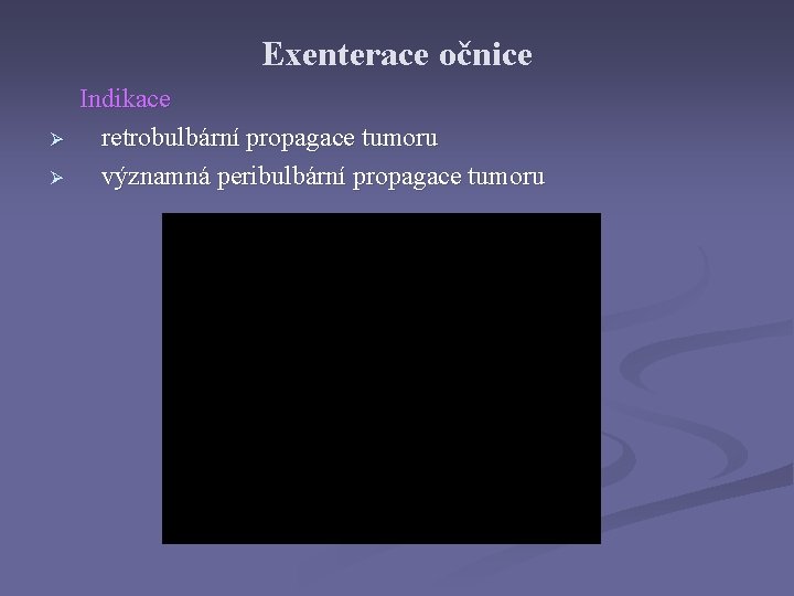 Exenterace očnice Ø Ø Indikace retrobulbární propagace tumoru významná peribulbární propagace tumoru 