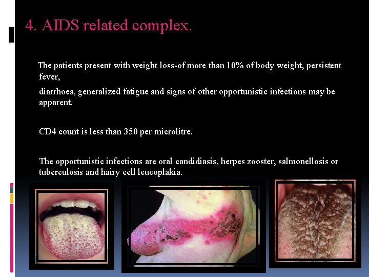 4. AIDS related complex. The patients present with weight loss-of more than 10% of