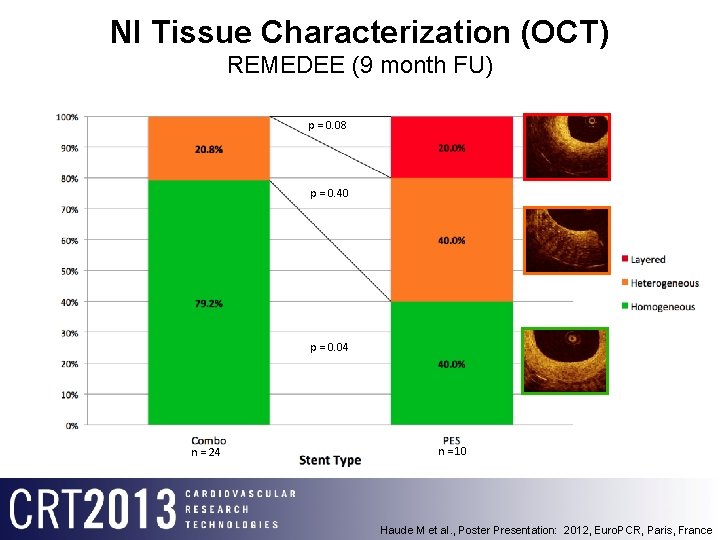 NI Tissue Characterization (OCT) REMEDEE (9 month FU) p = 0. 08 p =