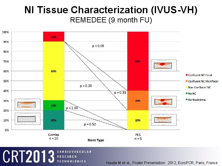 NI Tissue Characterization (IVUS-VH) REMEDEE (9 month FU) p = 0. 08 p =