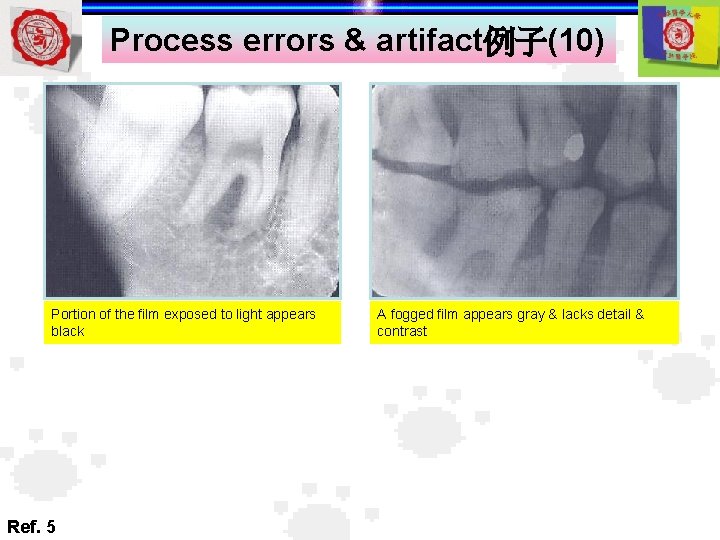 Process errors & artifact例子(10) Portion of the film exposed to light appears black Ref.