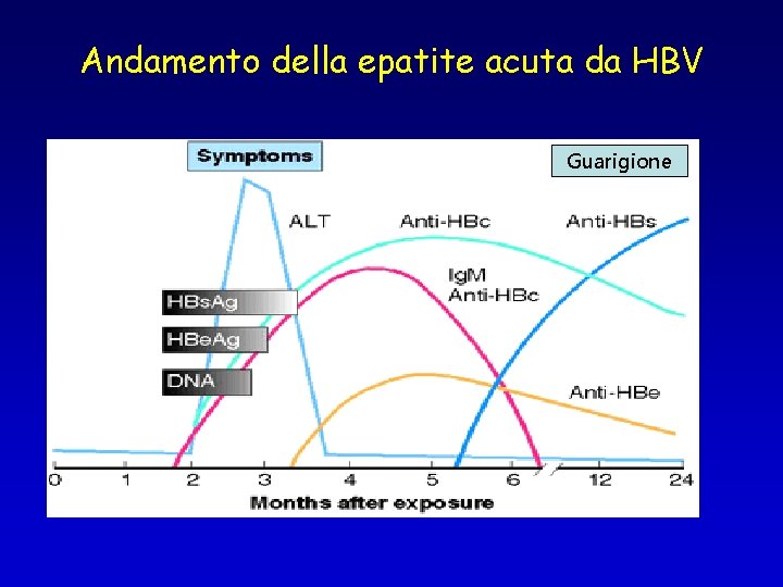Andamento della epatite acuta da HBV Guarigione 