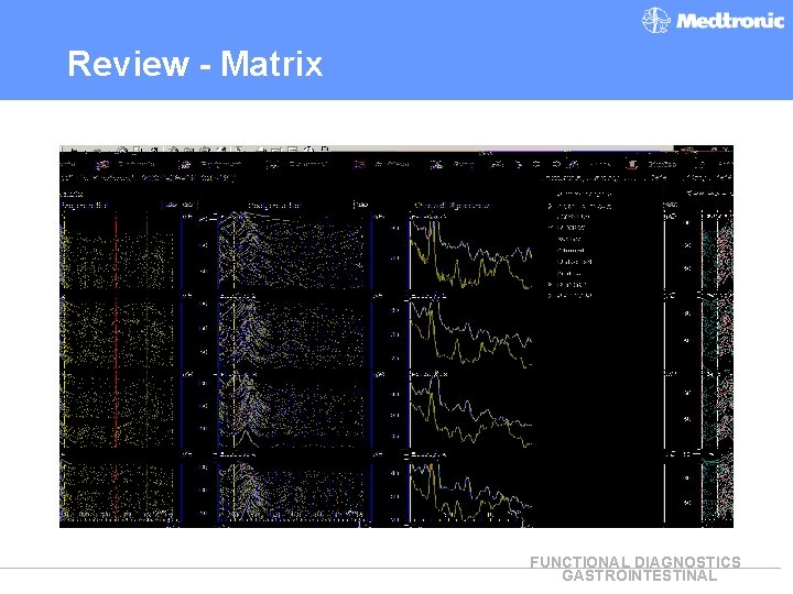 Review - Matrix FUNCTIONAL DIAGNOSTICS GASTROINTESTINAL 