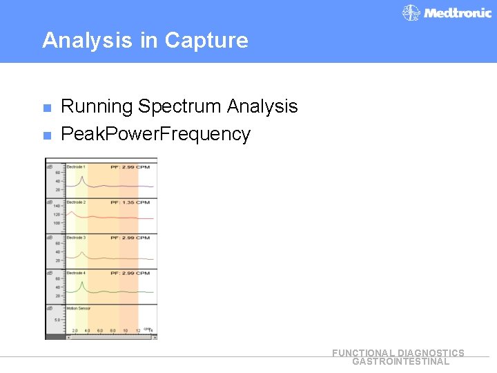 Analysis in Capture n n Running Spectrum Analysis Peak. Power. Frequency FUNCTIONAL DIAGNOSTICS GASTROINTESTINAL