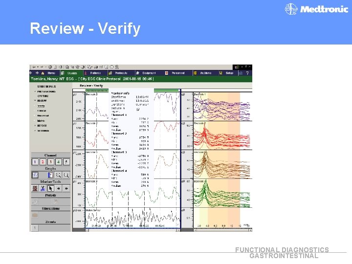 Review - Verify FUNCTIONAL DIAGNOSTICS GASTROINTESTINAL 