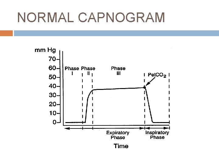NORMAL CAPNOGRAM 