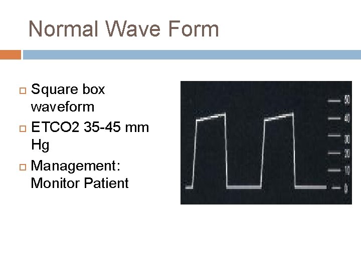 Normal Wave Form Square box waveform ETCO 2 35 -45 mm Hg Management: Monitor