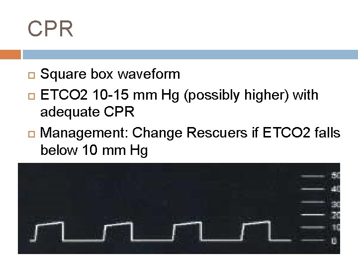 CPR Square box waveform ETCO 2 10 -15 mm Hg (possibly higher) with adequate