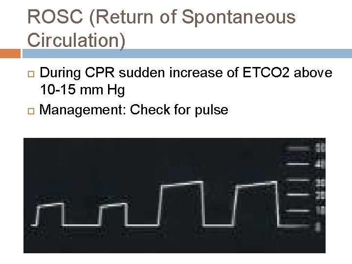 ROSC (Return of Spontaneous Circulation) During CPR sudden increase of ETCO 2 above 10