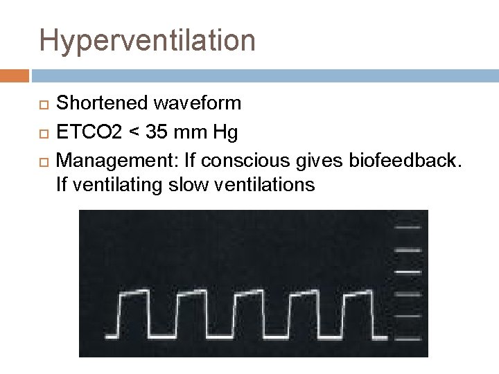 Hyperventilation Shortened waveform ETCO 2 < 35 mm Hg Management: If conscious gives biofeedback.