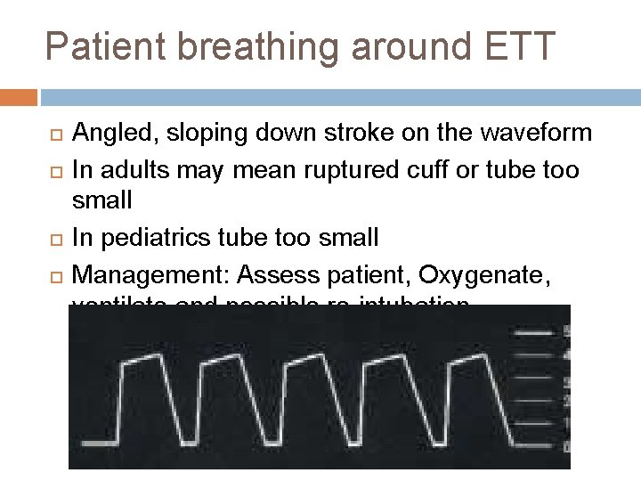 Patient breathing around ETT Angled, sloping down stroke on the waveform In adults may