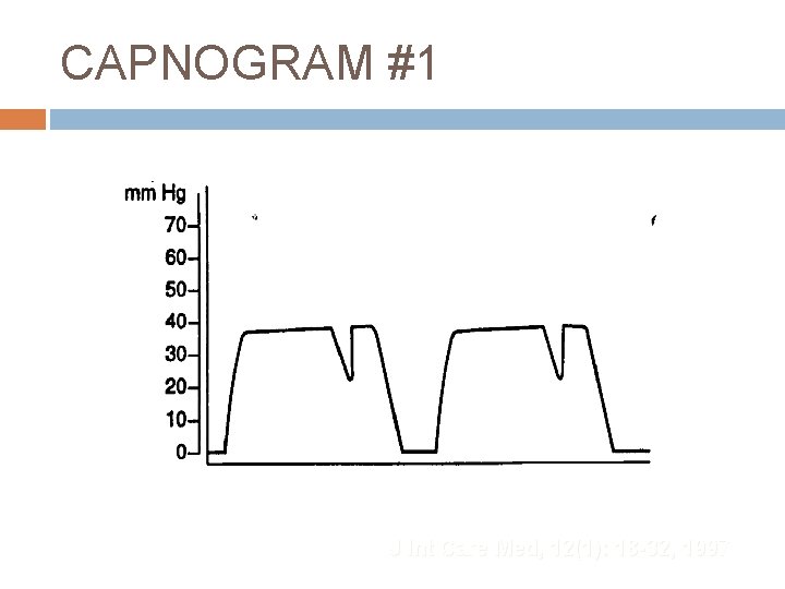 CAPNOGRAM #1 J Int Care Med, 12(1): 18 -32, 1997 