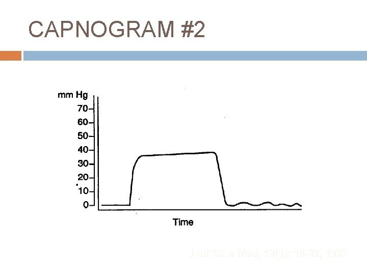 CAPNOGRAM #2 J Int Care Med, 12(1): 18 -32, 1997 