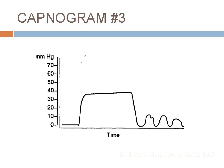 CAPNOGRAM #3 J Int Care Med, 12(1): 18 -32, 1997 
