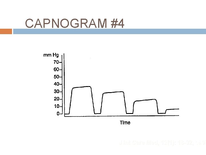 CAPNOGRAM #4 J Int Care Med, 12(1): 18 -32, 1997 