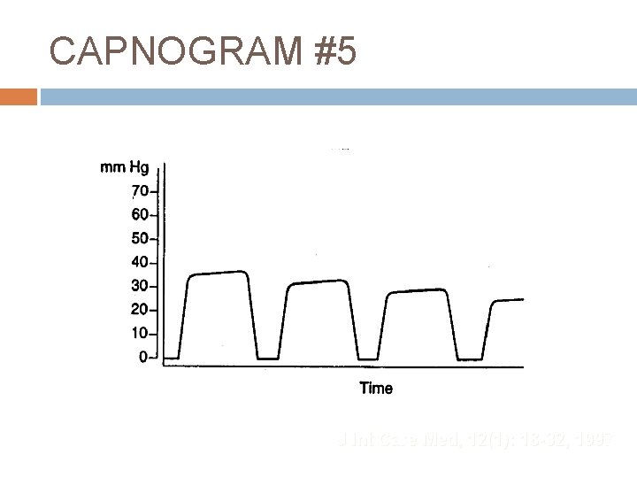 CAPNOGRAM #5 J Int Care Med, 12(1): 18 -32, 1997 