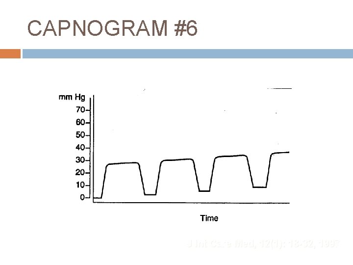 CAPNOGRAM #6 J Int Care Med, 12(1): 18 -32, 1997 