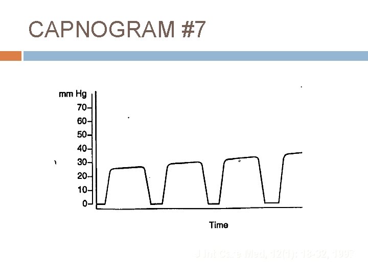 CAPNOGRAM #7 J Int Care Med, 12(1): 18 -32, 1997 
