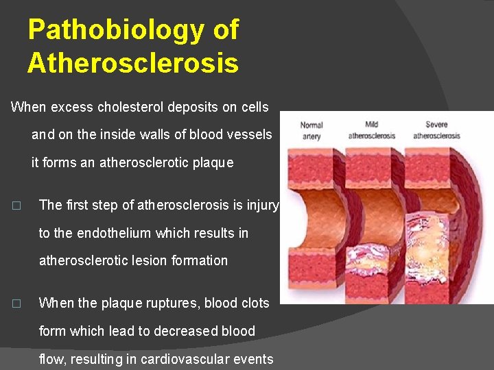 Pathobiology of Atherosclerosis When excess cholesterol deposits on cells and on the inside walls