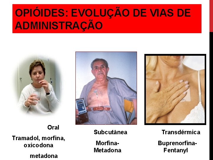 OPIÓIDES: EVOLUÇÃO DE VIAS DE ADMINISTRAÇÃO Oral Tramadol, morfina, oxicodona metadona Subcutânea Transdérmica Morfina.