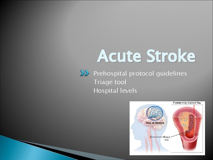 Acute Stroke Prehospital protocol guidelines Triage tool Hospital levels 
