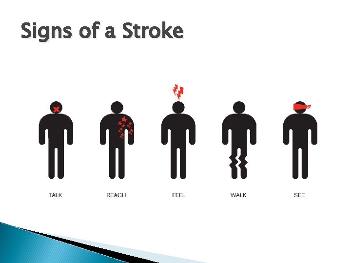 Signs of a Stroke 