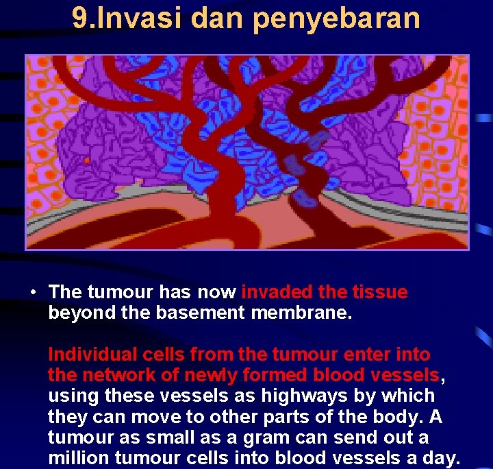 9. Invasi dan penyebaran • The tumour has now invaded the tissue beyond the