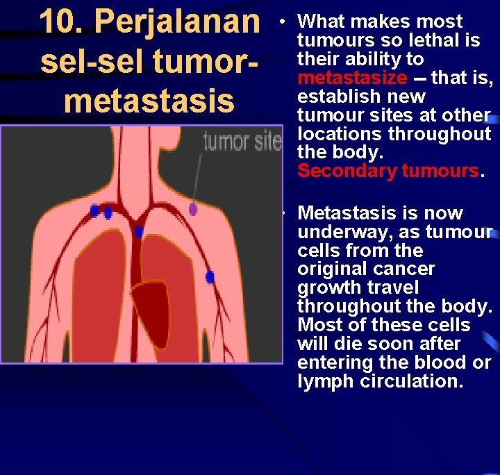 10. Perjalanan • sel-sel tumor- metastasis What makes most tumours so lethal is their