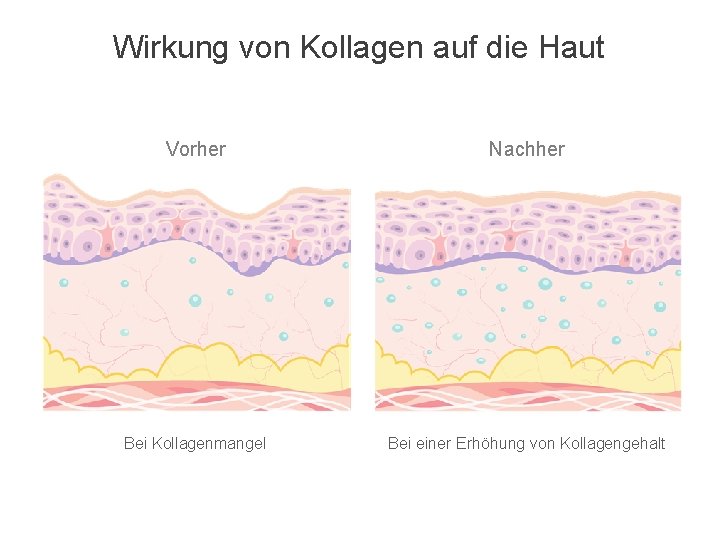 Wirkung von Kollagen auf die Haut Vorher Nachher Bei Kollagenmangel Bei einer Erhöhung von