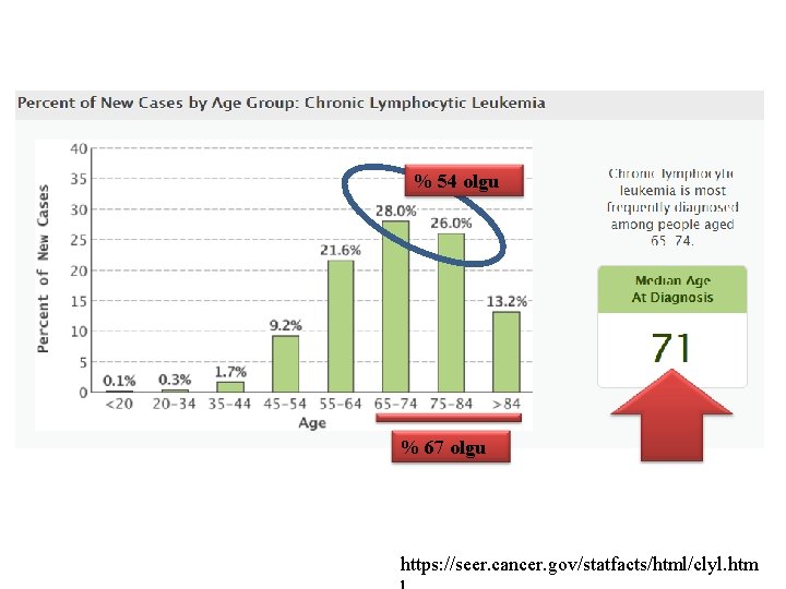 % 54 olgu % 67 olgu https: //seer. cancer. gov/statfacts/html/clyl. htm 