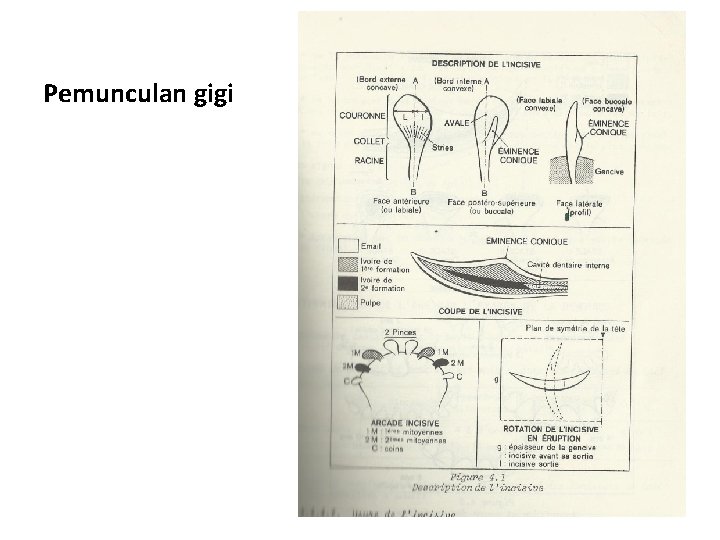 Pemunculan gigi 