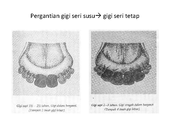 Pergantian gigi seri susu gigi seri tetap 