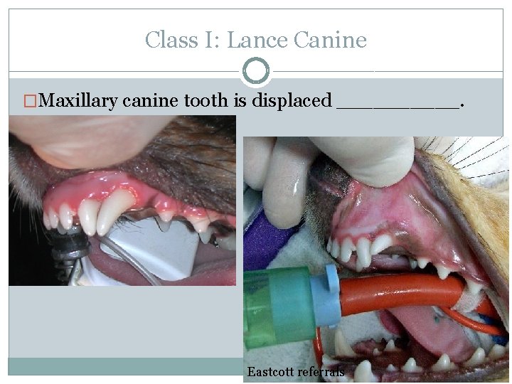 Class I: Lance Canine �Maxillary canine tooth is displaced _____. Eastcott referrals 