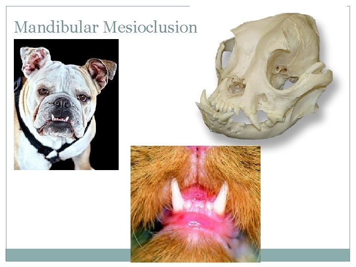 Mandibular Mesioclusion 