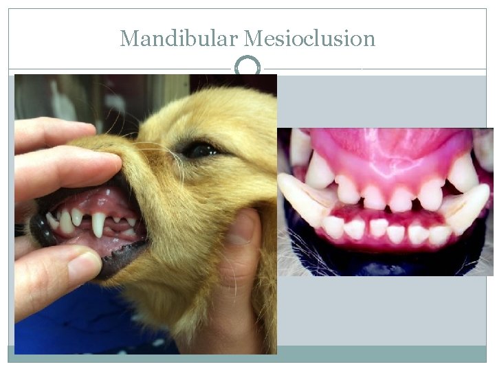 Mandibular Mesioclusion 