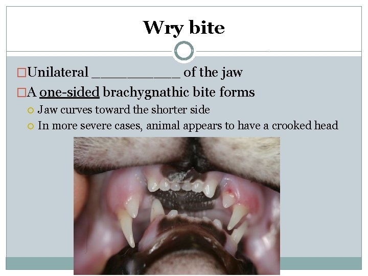 Wry bite �Unilateral _____ of the jaw �A one-sided brachygnathic bite forms Jaw curves