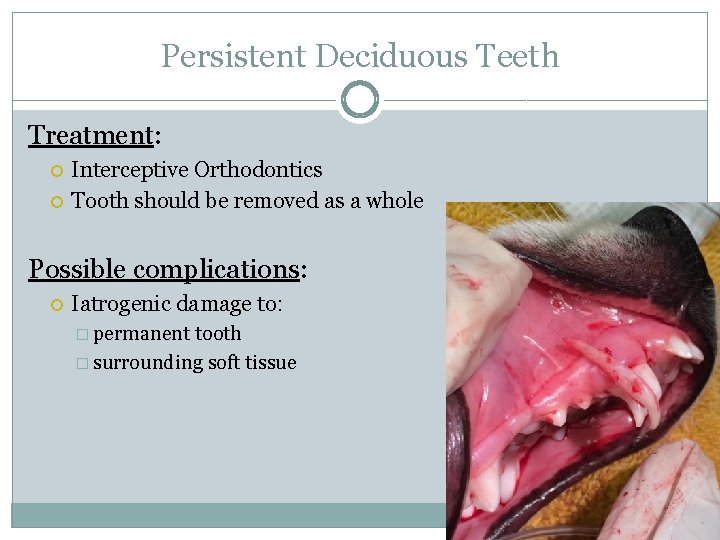 Persistent Deciduous Teeth Treatment: Interceptive Orthodontics Tooth should be removed as a whole Possible